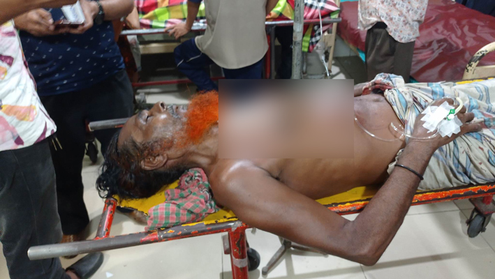 চনপাড়ায় দু’গ্রুপের গোলাগুলি, গুলিবিদ্ধ ঢামেকে চিকিৎসাধীন